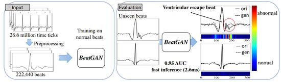 BeatGAN: Anomalous Rhythm Detection using Adversarially Generated Time Series